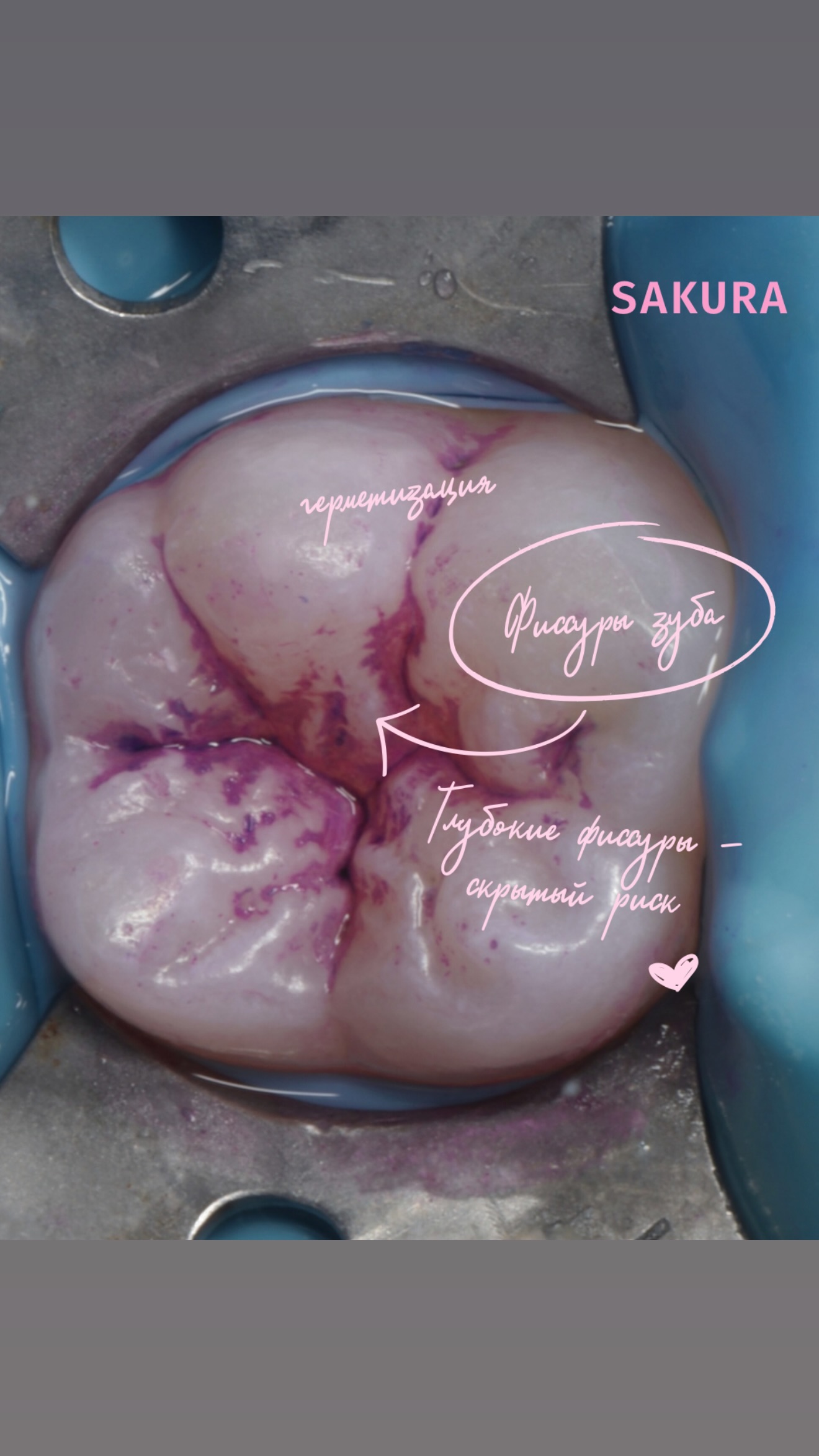 Герметизация — процесс