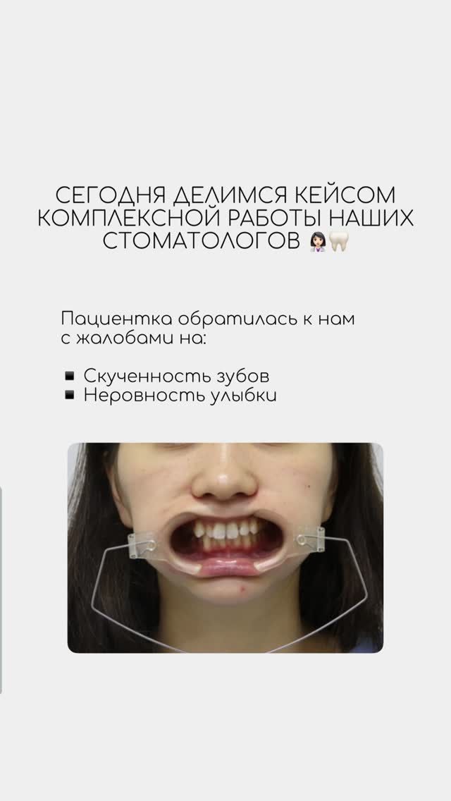 Ортодонтия